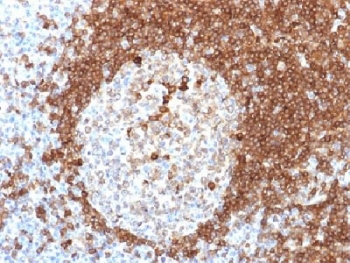CD79A / CD79 Alpha Antibody - IHC testing of FFPE human tonsil tissue with CD79a antibody (clone HM57). Required HIER: boil tissue sections in 10mM citrate buffer, pH 6, for 10-20 min.