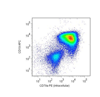 CD79A / CD79 Alpha Antibody - Intracellular staining of CD79a with anti-CD79a (HM57) PE (gated on leukemic blast cells) in a patient with childhood B-precursor ALL.