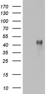 CD79A / CD79 Alpha Antibody - HEK293T cells were transfected with the pCMV6-ENTRY control (Left lane) or pCMV6-ENTRY CD79A (Right lane) cDNA for 48 hrs and lysed. Equivalent amounts of cell lysates (5 ug per lane) were separated by SDS-PAGE and immunoblotted with anti-CD79A.