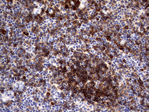 CD79A / CD79 Alpha Antibody - IHC of paraffin-embedded Human tonsil using anti-CD79A mouse monoclonal antibody. (Heat-induced epitope retrieval by 1 mM EDTA in 10mM Tris, pH8.5, 120°C for 3min).