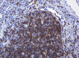 CD79A / CD79 Alpha Antibody - IHC of paraffin-embedded Human lymph node tissue using anti-CD79A mouse monoclonal antibody.