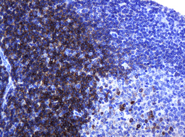 CD79A / CD79 Alpha Antibody - IHC of paraffin-embedded Human tonsil using anti-CD79A mouse monoclonal antibody.