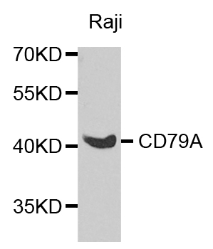 CD79A / CD79 Alpha Antibody - Western blot analysis of extracts of Raji cells, using CD79A antibody at 1:1000 dilution. The secondary antibody used was an HRP Goat Anti-Rabbit IgG (H+L) at 1:10000 dilution. Lysates were loaded 25ug per lane and 3% nonfat dry milk in TBST was used for blocking. An ECL Kit was used for detection and the exposure time was 90s.