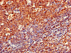 CD79A / CD79 Alpha Antibody - Immunohistochemistry of paraffin-embedded human tonsil tissue using CD79A Antibody at dilution of 1:100