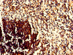 CD79A / CD79 Alpha Antibody - Immunohistochemistry of paraffin-embedded human spleen tissue using CD79A Antibody at dilution of 1:100