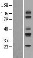 CD79A / CD79 Alpha Protein - Western validation with an anti-DDK antibody * L: Control HEK293 lysate R: Over-expression lysate