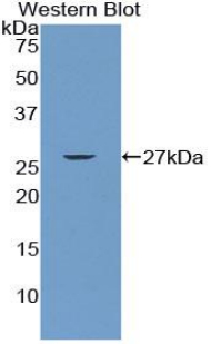 CD79B / CD79 Beta Antibody - Western blot of recombinant CD79B.  This image was taken for the unconjugated form of this product. Other forms have not been tested.