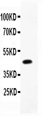 CD79B / CD79 Beta Antibody - CD79B antibody Western blot. All lanes: Anti CD79B at 0.5 ug/ml. WB: Recombinant Human CD79B Protein 0.5ng. Predicted band size: 45 kD. Observed band size: 45 kD.