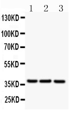 CD79B / CD79 Beta Antibody - CD79B antibody Western blot. All lanes: Anti CD79b at 0.5 ug/ml. Lane 1: Raji Whole Cell Lysate at 40 ug. Lane 2: Hl-60 Whole Cell Lysate at 40 ug. Lane 3: HUT Whole Cell Lysate at 40 ug. Predicted band size: 26 kD. Observed band size: 35 kD.