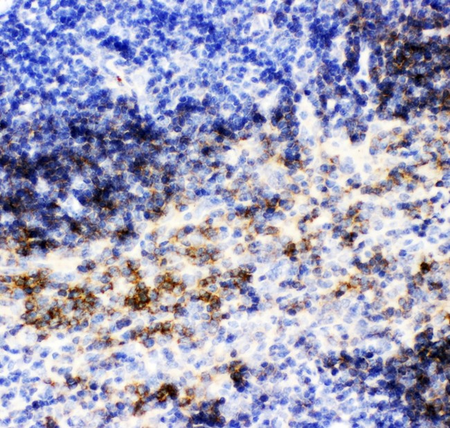 CD79B / CD79 Beta Antibody - CD79B antibody IHC-paraffin: Mouse Spleen Tissue.
