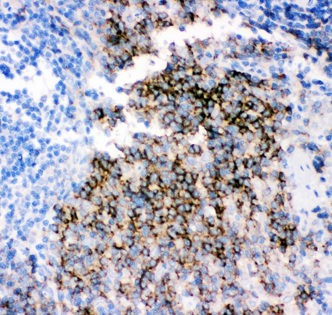 CD79B / CD79 Beta Antibody - CD79B antibody IHC-paraffin: Rat Spleen Tissue.
