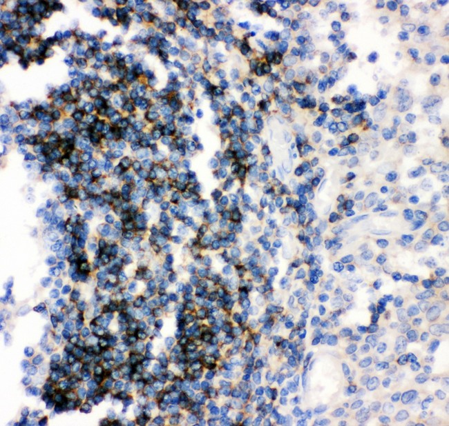 CD79B / CD79 Beta Antibody - CD79B antibody IHC-paraffin: Human Tonsil Tissue.