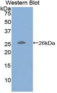 CD79B / CD79 Beta Antibody - Western blot of recombinant CD79B.  This image was taken for the unconjugated form of this product. Other forms have not been tested.