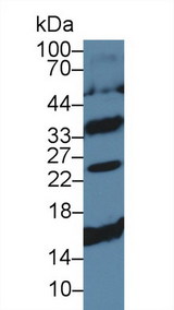 CD79B / CD79 Beta Antibody - Western Blot; Sample: Mouse Spleen lysate; Primary Ab: 5µg/ml Rabbit Anti-Human Igb Antibody Second Ab: 0.2µg/mL HRP-Linked Caprine Anti-Rabbit IgG Polyclonal Antibody