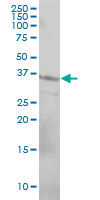 CD79B / CD79 Beta Antibody - CD79B monoclonal antibody (M01), clone 4E10-2A10 Western Blot analysis of CD79B expression in HeLa.