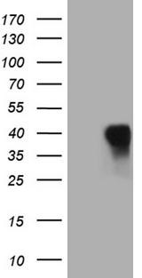 CD79B / CD79 Beta Antibody - HEK293T cells were transfected with the pCMV6-ENTRY control. (Left lane) or pCMV6-ENTRY CD79B. (Right lane) cDNA for 48 hrs and lysed. Equivalent amounts of cell lysates. (5 ug per lane) were separated by SDS-PAGE and immunoblotted with anti-CD79B. (1:2000)