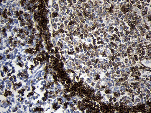 CD79B / CD79 Beta Antibody - Immunohistochemical staining of paraffin-embedded Human lymph node tissue within the normal limits using anti-CD79B mouse monoclonal antibody. (Heat-induced epitope retrieval by 1mM EDTA in 10mM Tris buffer. (pH8.5) at 120°C for 3 min. (1:2000)