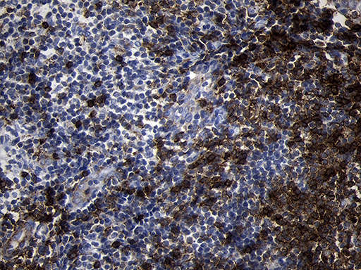 CD79B / CD79 Beta Antibody - Immunohistochemical staining of paraffin-embedded Human tonsil within the normal limits using anti-CD79B mouse monoclonal antibody. (Heat-induced epitope retrieval by 1mM EDTA in 10mM Tris buffer. (pH8.5) at 120°C for 3 min. (1:2000)