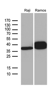 CD79B / CD79 Beta Antibody - Western blot analysis of extracts. (35ug) from 2 different cell lines by using anti-CD79B monoclonal antibody. (1:500)