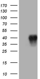 CD79B / CD79 Beta Antibody - HEK293T cells were transfected with the pCMV6-ENTRY control. (Left lane) or pCMV6-ENTRY CD79B. (Right lane) cDNA for 48 hrs and lysed. Equivalent amounts of cell lysates. (5 ug per lane) were separated by SDS-PAGE and immunoblotted with anti-CD79B. (1:2000)