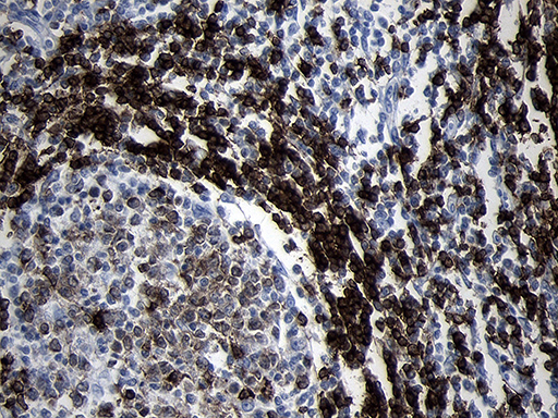 CD79B / CD79 Beta Antibody - Immunohistochemical staining of paraffin-embedded Human lymph node tissue within the normal limits using anti-CD79B mouse monoclonal antibody. (Heat-induced epitope retrieval by 1mM EDTA in 10mM Tris buffer. (pH8.5) at 120°C for 3 min. (1:2000)