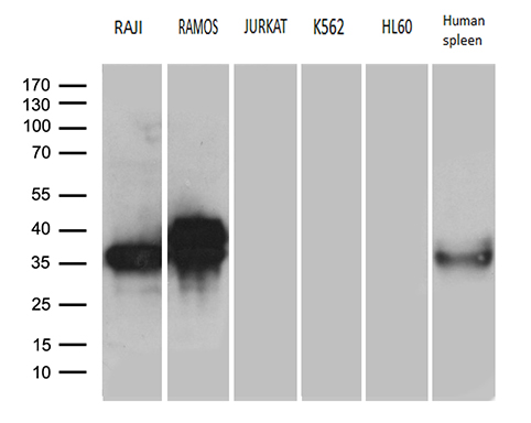 CD79B / CD79 Beta Antibody - Western blot analysis of extracts. (35ug) from 5 different cell lines and human spleen tissue lysate by using anti-CD79A monoclonal antibody. (1:500)