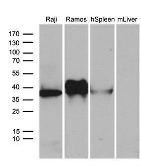 CD79B / CD79 Beta Antibody - Western blot analysis of extracts. (35ug) from 2 different cell lines and 2 different tissue lines by using anti-CD79B monoclonal antibody. (1:500)