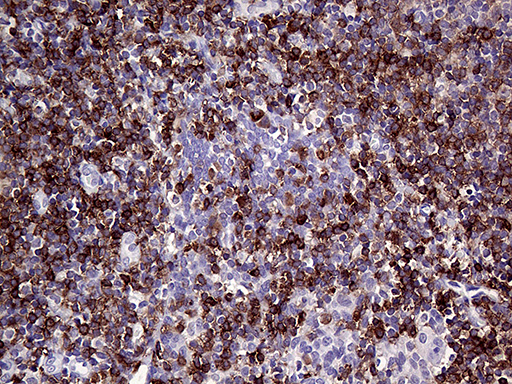 CD79B / CD79 Beta Antibody - Immunohistochemical staining of paraffin-embedded Human tonsil within the normal limits using anti-CD79B mouse monoclonal antibody. (Heat-induced epitope retrieval by 1mM EDTA in 10mM Tris buffer. (pH8.5) at 120°C for 3 min. (1:2000)