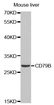 CD79B / CD79 Beta Antibody - Western blot analysis of extracts of mouse liver tissue cell line, using CD79B antibody.