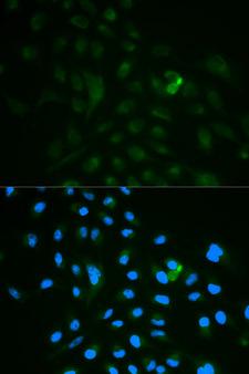 CD79B / CD79 Beta Antibody - Immunofluorescence analysis of MCF7 cell using CD79B antibody. Blue: DAPI for nuclear staining.