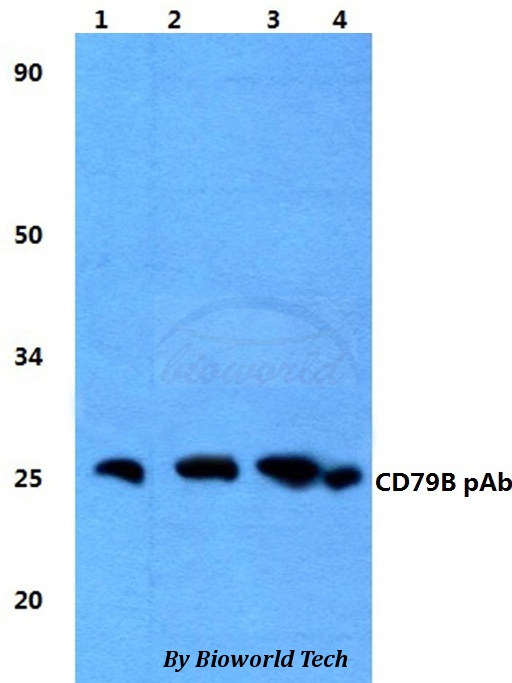 CD79B / CD79 Beta Antibody - Western blot of CD79B antibody at 1:500 dilution. Lane 1: HEK293T whole cell lysate. Lane 2: sp2/0 whole cell lysate. Lane 3: H9C6 whole cell lysate.