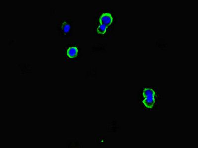 CD79B / CD79 Beta Antibody - Immunofluorescent analysis of mcf-7 cells diluted at 1:100 and Alexa Fluor 488-congugated AffiniPure Goat Anti-Rabbit IgG(H+L)