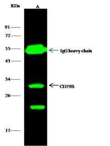 CD79B / CD79 Beta Antibody - CD79b was immunoprecipitated using: Lane A: 0.5 mg Daudi Whole Cell Lysate. 4 uL anti-CD79b rabbit polyclonal antibody and 15 ul of 50% Protein G agarose. Primary antibody: Anti-CD79b rabbit polyclonal antibody, at 1:100 dilution. Secondary antibody: Dylight 800-labeled antibody to rabbit IgG (H+L), at 1:5000 dilution. Developed using the odssey technique. Performed under reducing conditions. Predicted band size: 33 kDa. Observed band size: 33 kDa.