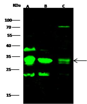 CD79B / CD79 Beta Antibody - Anti-CD79B rabbit polyclonal antibody at 1:500 dilution. Lane A: Daudi Whole Cell Lysate. Lane B: Hela Whole Cell Lysate. Lane C: Mosue liver Whole Cell Lysate. Lysates/proteins at 30 ug per lane. Secondary: Goat Anti-Rabbit IgG H&L (Dylight 800) at 1/10000 dilution. Developed using the Odyssey technique. Performed under reducing conditions. Predicted band size: 26 kDa. Observed band size: 33 kDa.