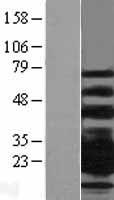 CD79B / CD79 Beta Protein - Western validation with an anti-DDK antibody * L: Control HEK293 lysate R: Over-expression lysate