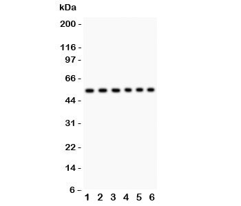 CD8 Antibody - Western blot testing of CD8 antibody and Lane 1: Jurkat; 2: Raji; 3: HL-60; 4: A549; 5: COLO320; 6: HeLa lysate; Predicted size: 34KD; Observed size: 34~60KD depending on glycosylation level