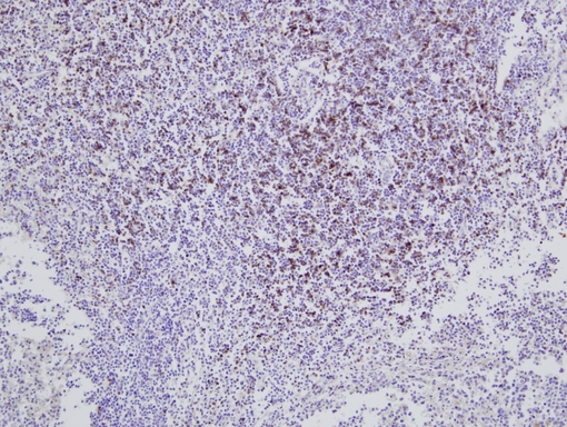 CD8 Antibody - Bovine lymph node stained with Mouse anti-Bovine CD8 10x. Image courtesy of Dr. J.B. Silvan, Moredun Research Institute, Roslin, UK.  This image was taken for the unconjugated form of this product. Other forms have not been tested.