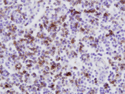 CD8 Antibody - Bovine lymph node stained with Mouse anti-Bovine CD8 40x. Image courtesy of Dr. J.B. Silvan, Moredun Research Institute, Roslin, UK.  This image was taken for the unconjugated form of this product. Other forms have not been tested.