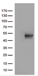 CD80 Antibody - HEK293T cells were transfected with the pCMV6-ENTRY control. (Left lane) or pCMV6-ENTRY CD80. (Right lane) cDNA for 48 hrs and lysed. Equivalent amounts of cell lysates. (5 ug per lane) were separated by SDS-PAGE and immunoblotted with anti-CD80. (1:500)