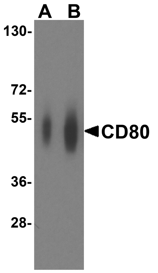 CD80 Antibody - Western blot analysis of CD80 in overexpressing HEK293 cells CD80 antibody at 0.25 and 0.5 ug/ml