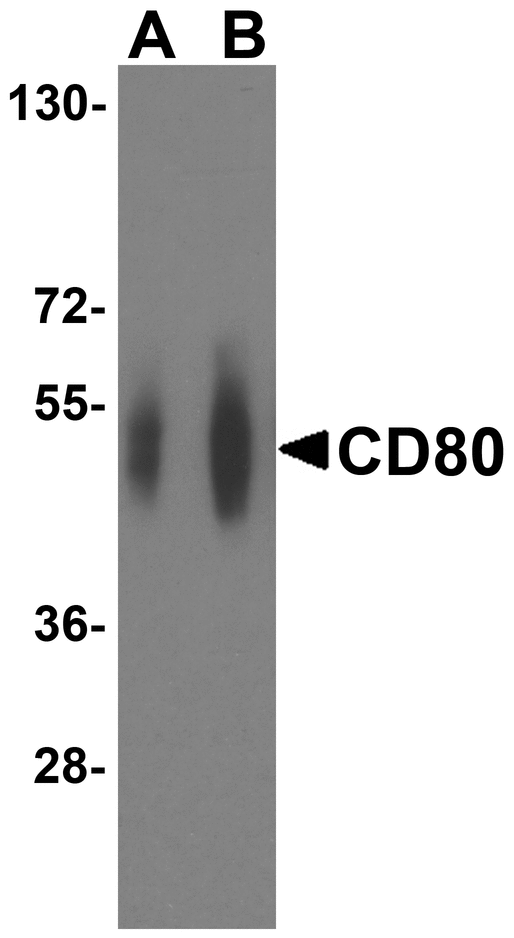 CD80 Antibody - Western blot analysis of CD80 in overexpressing HEK293 cells CD80 antibody at 0.25 and 0.5 ug/ml