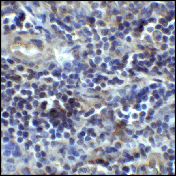CD80 Antibody - Immunohistochemistry of CD80 in human tonsil tissue with CD80 antibody at 5 ug/mL.