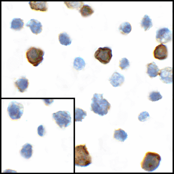 CD80 Antibody - Immunocytochemistry of CD80 in transfected HEK293 cells with CD80 antibody at 1 ug/mL. Lower left: Immunocytochemistry in transfected HEK293 cells with control mouse IgG antibody at 1 ug/mL.