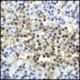 CD80 Antibody - Immunohistochemistry of CD80 in human tonsil tissue with CD80 antibody at 5 ug/mL.