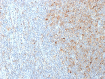 CD80 Antibody - IHC staining of FFPE human lymph node with CD80 antibody (clone C80/2723). HIER: boil tissue sections in 10mM Tris buffer with 1mM EDTA, pH 9, for 10-20 min and allow to cool before testing.