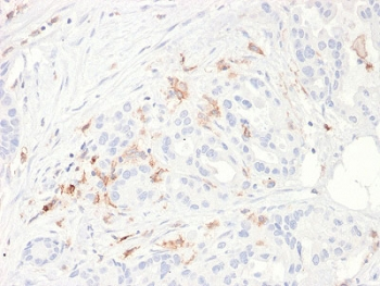 CD80 Antibody - IHC staining of FFPE human small intestine with CD80 antibody (clone C80/2723). HIER: boil tissue sections in 10mM Tris buffer with 1mM EDTA, pH 9, for 10-20 min and allow to cool before testing.