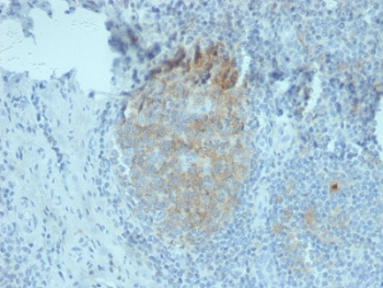 CD80 Antibody - IHC staining of FFPE human tonsil tissue with CD80 antibody (clone C80/2776). HIER: boil tissue sections in 10mM Tris buffer with 1mM EDTA, pH 9, for 10-20 min and allow to cool before testing.