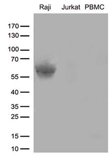 CD80 Antibody - Western blot analysis of extracts. (35ug) from cell lines and/or tissue lysates by using anti-CD80 monoclonal antibody. (1:500)