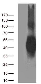 CD80 Antibody - HEK293T cells were transfected with the pCMV6-ENTRY control. (Left lane) or pCMV6-ENTRY CD80. (Right lane) cDNA for 48 hrs and lysed. Equivalent amounts of cell lysates. (5 ug per lane) were separated by SDS-PAGE and immunoblotted with anti-CD80. (1:500)