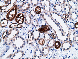 CD80 Antibody - Immunohistochemical staining of paraffin-embedded Human Kidney tissue using anti-CD80 mouse monoclonal antibody.
